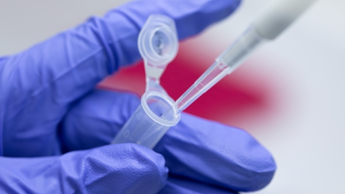 地域に貢献！新型コロナウイルス感染症対策で東京薬科大学PCR検査センターを設立｜プレスリリース