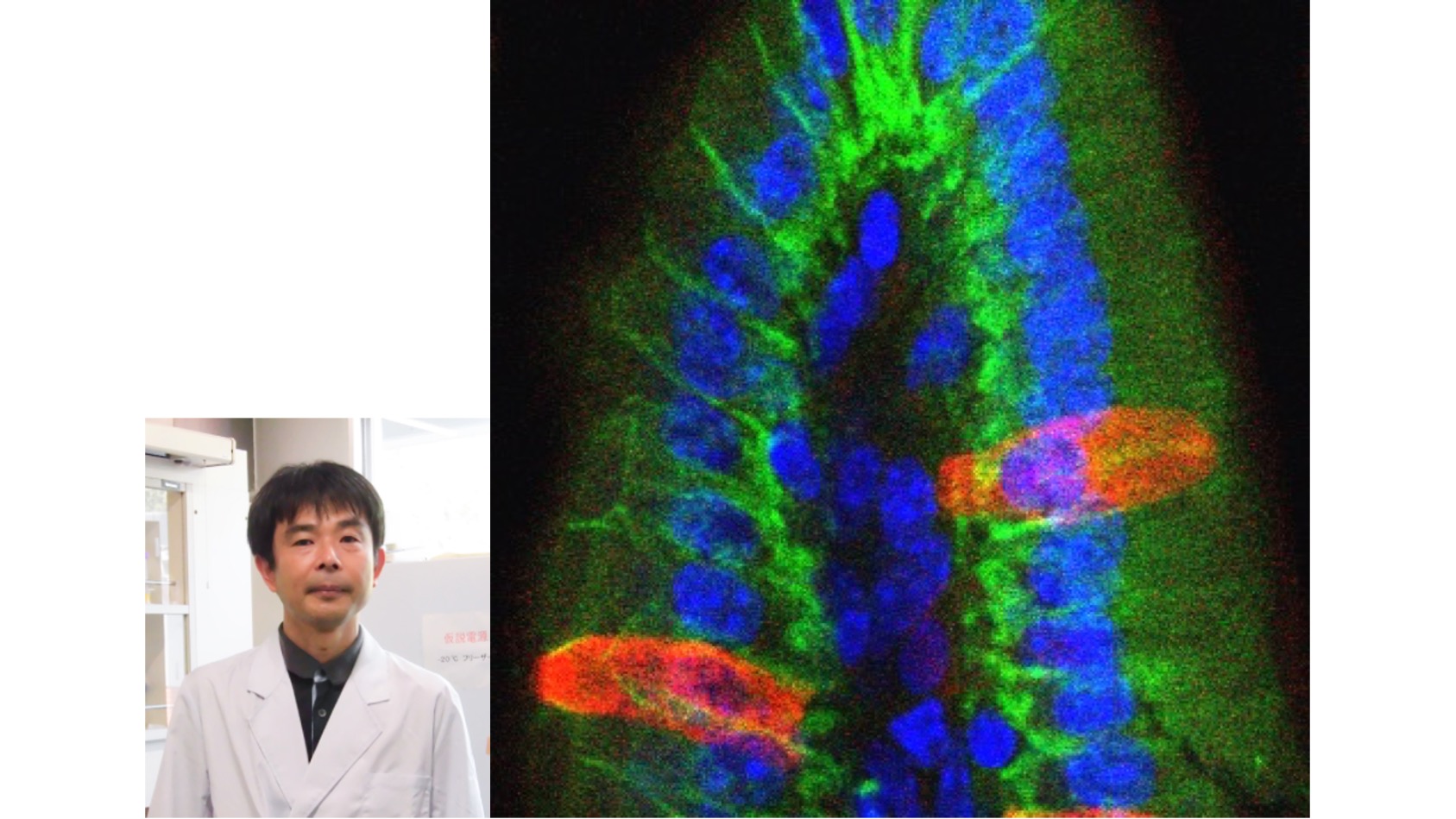 まめ知識を更新しました「腸管の寄生虫免疫応答に働く細胞の話 ～腸タフト細胞～」