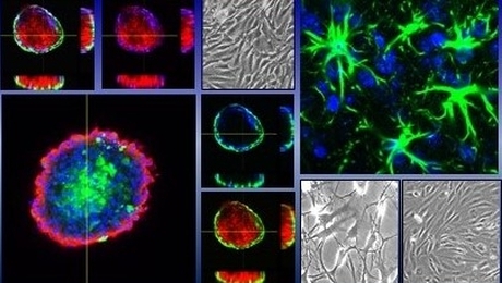 人工的にヒトを創る！？薬の開発を変えるミニ臓器