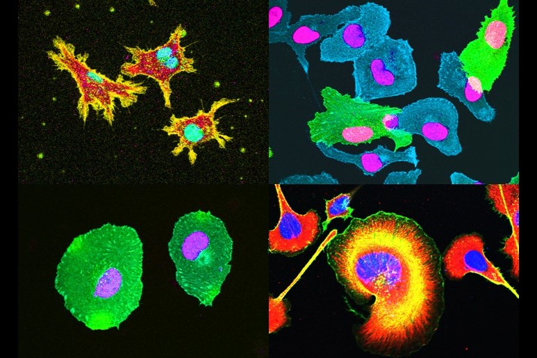 東薬の先端研究「創薬・再生医療を目指した細胞接着分子の機能解明と応用｜野水 基義 教授」を公開しました