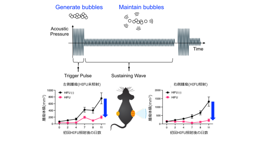 泡を作り出す超音波で体を傷つけずにがんの免疫治療を実現 〜新しい超音波技術で遠隔部位の腫瘍まで縮小に成功〜