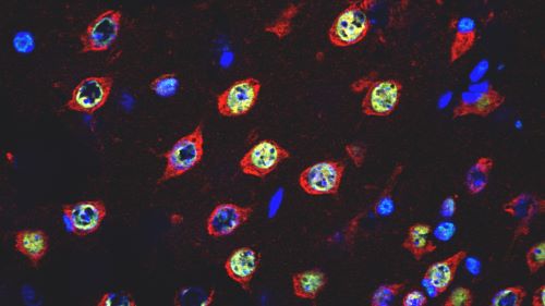 「研究者が語る 東薬の先端研究　『神経細胞を守ることは健康寿命を延ばすこと』」を公開しました